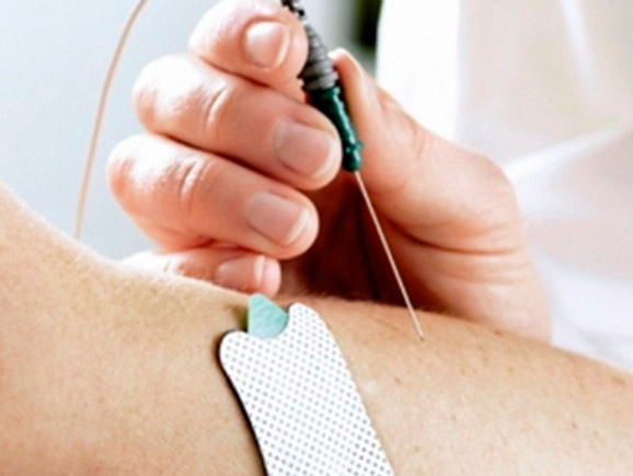 Eletroneuromiografia